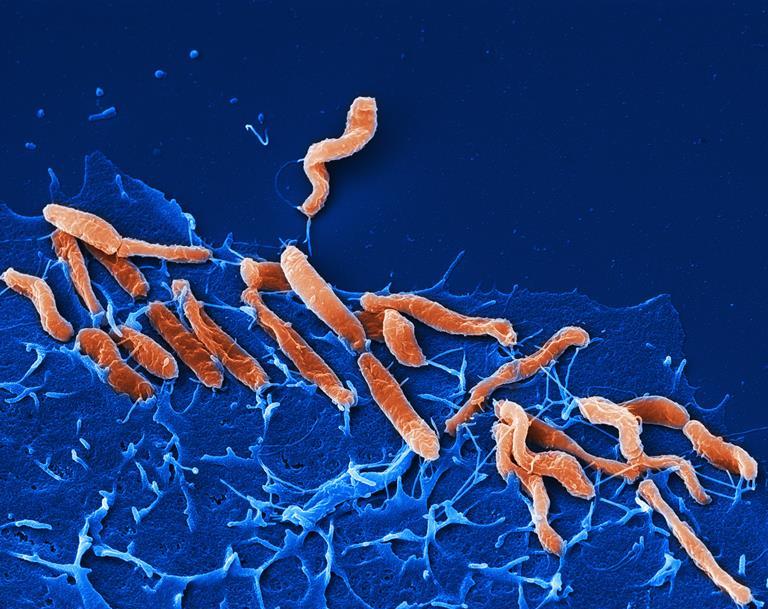 Helicobacter Pylori Signs Of Selection In The Stomach German Center